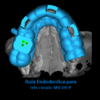 GUIA ENDODONTICA (ENDOGUIDE) BROCAS EG DSM PARA ACESSO A 3 CANAIS CALCIFICADOS