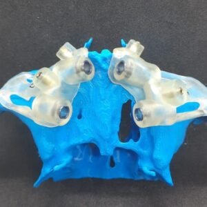 GUIA CIRURGICO ZIGOMATICO PARA 2 IMPLANTES